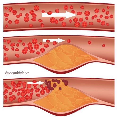 Cholesterol trong máu